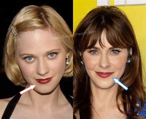 zooey deschanel filler|Zooey Deschanel Before and After